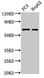 PARP2 Antibody - Positive Western Blot detected in PC3 whole cell lysate, HepG2 whole cell lysate. All lanes: PARP2 antibody at 3 µg/ml Secondary Goat polyclonal to rabbit IgG at 1/50000 dilution. Predicted band size: 67, 65 KDa. Observed band size: 67 KDa