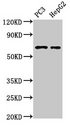 PARP2 Antibody - Positive Western Blot detected in PC3 whole cell lysate, HepG2 whole cell lysate. All lanes: PARP2 antibody at 3 µg/ml Secondary Goat polyclonal to rabbit IgG at 1/50000 dilution. Predicted band size: 67, 65 KDa. Observed band size: 67 KDa