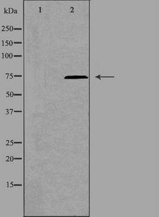 PARP2 Antibody - Western blot analysis of extracts of K562 cells using PARP2 antibody. The lane on the left is treated with the antigen-specific peptide.
