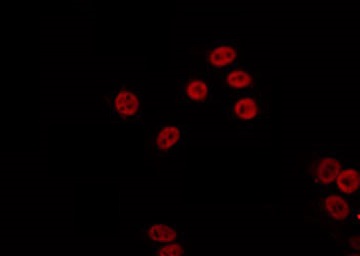 PARP2 Antibody - Staining K562 cells by IF/ICC. The samples were fixed with PFA and permeabilized in 0.1% Triton X-100, then blocked in 10% serum for 45 min at 25°C. The primary antibody was diluted at 1:200 and incubated with the sample for 1 hour at 37°C. An Alexa Fluor 594 conjugated goat anti-rabbit IgG (H+L) Ab, diluted at 1/600, was used as the secondary antibody.