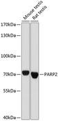 PARP2 Antibody - Western blot analysis of extracts of various cell lines using PARP2 Polyclonal Antibody at dilution of 1:1000.