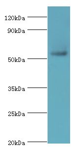 PARP3 Antibody - Western blot. All lanes: Poly [ADP-ribose] polymerase 3 antibody at 2 ug/ml+mouse heart tissue. Secondary antibody: Goat polyclonal to rabbit at 1:10000 dilution. Predicted band size: 60 kDa. Observed band size: 60 kDa.