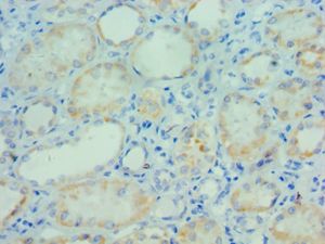 PARP3 Antibody - Immunohistochemistry of paraffin-embedded human kidney using antibody at 1:100 dilution.