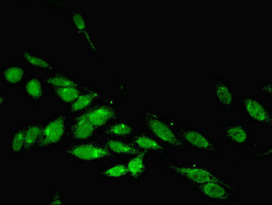 PARP3 Antibody - Immunofluorescent analysis of Hela cells using PARP3 Antibody at dilution of 1:100 and Alexa Fluor 488-congugated AffiniPure Goat Anti-Rabbit IgG(H+L)