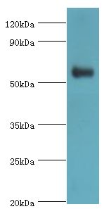 PARP3 Antibody - Western blot. All lanes: Poly [ADP-ribose] polymerase 3 antibody at 7 ug/ml+mouse kidney tissue. Secondary antibody: Goat polyclonal to rabbit at 1:10000 dilution. Predicted band size: 60 kDa. Observed band size: 60 kDa.
