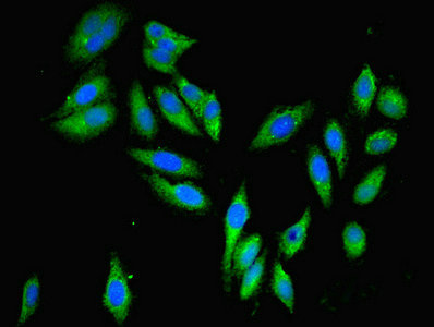 PARP3 Antibody - Immunofluorescent analysis of Hela cells using PARP3 Antibody at dilution of 1:100 and Alexa Fluor 488-congugated AffiniPure Goat Anti-Rabbit IgG(H+L)