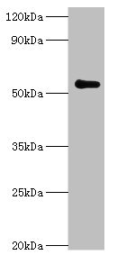 PARP3 Antibody - Western blot All lanes: Poly [ADP-ribose] polymerase 3 antibody at 7µg/ml + Mouse kidney tissue Secondary Goat polyclonal to rabbit IgG at 1/10000 dilution Predicted band size: 60 kDa Observed band size: 60 kDa