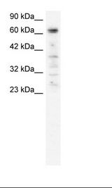 PARP3 Antibody - HepG2 Cell Lysate.  This image was taken for the unconjugated form of this product. Other forms have not been tested.
