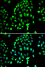 PARP3 Antibody - Immunofluorescence analysis of MCF7 cells.