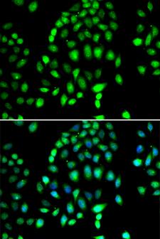 PARP3 Antibody - Immunofluorescence analysis of MCF7 cells.