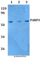 PARP3 Antibody - Western blot of PARP3 antibody at 1:500 dilution. Lane 1: HEK293T whole cell lysate. Lane 2: RAW264.7 whole cell lysate.