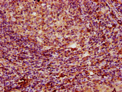 PARP3 Antibody - Immunohistochemistry Dilution at 1:100 and staining in paraffin-embedded human tonsil tissue performed on a Leica BondTM system. After dewaxing and hydration, antigen retrieval was mediated by high pressure in a citrate buffer (pH 6.0). Section was blocked with 10% normal Goat serum 30min at RT. Then primary antibody (1% BSA) was incubated at 4°C overnight. The primary is detected by a biotinylated Secondary antibody and visualized using an HRP conjugated SP system.