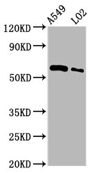 PARP3 Antibody - Western Blot Positive WB detected in: A549 whole cell lysate, LO2 whole cell lysate All Lanes: PARP3 antibody at 3.5µg/ml Secondary Goat polyclonal to rabbit IgG at 1/50000 dilution Predicted band size: 61 KDa Observed band size: 61 KDa