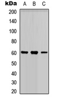 PARP3 Antibody - Western blot analysis of PARP3 expression in HEK293T (A); Raw264.7 (B); H9C2 (C) whole cell lysates.