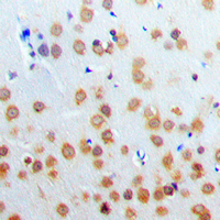 PARP3 Antibody - Immunohistochemical analysis of PARP3 staining in human brain formalin fixed paraffin embedded tissue section. The section was pre-treated using heat mediated antigen retrieval with sodium citrate buffer (pH 6.0). The section was then incubated with the antibody at room temperature and detected using an HRP conjugated compact polymer system. DAB was used as the chromogen. The section was then counterstained with hematoxylin and mounted with DPX.