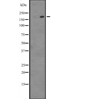 PARP4 / VPARP Antibody - Western blot analysis of PARP4 expression in HeLa cells lysate. The lane on the left is treated with the antigen-specific peptide.