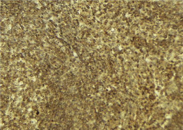 PARP4 / VPARP Antibody - 1:100 staining mouse pancreas tissue by IHC-P. The sample was formaldehyde fixed and a heat mediated antigen retrieval step in citrate buffer was performed. The sample was then blocked and incubated with the antibody for 1.5 hours at 22°C. An HRP conjugated goat anti-rabbit antibody was used as the secondary.