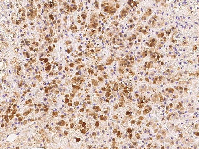 PARP4 / VPARP Antibody - Immunochemical staining of human PARP4 in human adrenal gland with rabbit polyclonal antibody at 1:100 dilution, formalin-fixed paraffin embedded sections.