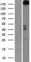 PARP4 / VPARP Protein - Western validation with an anti-DDK antibody * L: Control HEK293 lysate R: Over-expression lysate
