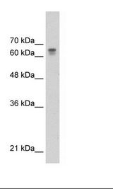 PARP6 Antibody - HepG2 Cell Lysate.  This image was taken for the unconjugated form of this product. Other forms have not been tested.