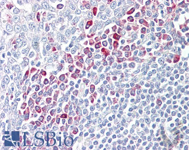 PARP6 Antibody - Anti-PARP6 antibody IHC of human tonsil. Immunohistochemistry of formalin-fixed, paraffin-embedded tissue after heat-induced antigen retrieval. Antibody dilution 2.5-5 ug/ml. This image was taken for the unconjugated form of this product. Other forms have not been tested.