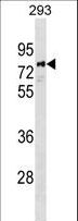 PARP6 Antibody - PARP6 Antibody western blot of 293 cell line lysates (35 ug/lane). The PARP6 antibody detected the PARP6 protein (arrow).
