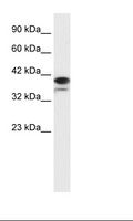 PARP6 Antibody - Daudi Cell Lysate.  This image was taken for the unconjugated form of this product. Other forms have not been tested.