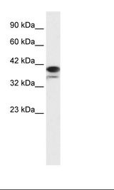 PARP6 Antibody - Daudi Cell Lysate.  This image was taken for the unconjugated form of this product. Other forms have not been tested.