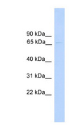 PARP6 Antibody - PARP6 antibody Western blot of 721_B cell lysate. This image was taken for the unconjugated form of this product. Other forms have not been tested.