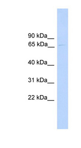 PARP6 Antibody - PARP6 antibody Western blot of 721_B cell lysate. This image was taken for the unconjugated form of this product. Other forms have not been tested.