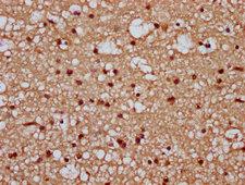 PARP7 / TIPARP Antibody - Immunohistochemistry Dilution at 1:300 and staining in paraffin-embedded human brain tissue performed on a Leica BondTM system. After dewaxing and hydration, antigen retrieval was mediated by high pressure in a citrate buffer (pH 6.0). Section was blocked with 10% normal Goat serum 30min at RT. Then primary antibody (1% BSA) was incubated at 4°C overnight. The primary is detected by a biotinylated Secondary antibody and visualized using an HRP conjugated SP system.