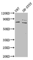 PARP7 / TIPARP Antibody - Western Blot Positive WB detected in: U87 whole cell lysate, SH-SY5Y whole cell lysate All lanes: TIPARP antibody at 4.6µg/ml Secondary Goat polyclonal to rabbit IgG at 1/50000 dilution Predicted band size: 77 kDa Observed band size: 77 kDa