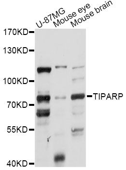 PARP7 / TIPARP Antibody - Western blot analysis of extracts of various cell lines, using TIPARP antibody at 1:1000 dilution. The secondary antibody used was an HRP Goat Anti-Rabbit IgG (H+L) at 1:10000 dilution. Lysates were loaded 25ug per lane and 3% nonfat dry milk in TBST was used for blocking. An ECL Kit was used for detection and the exposure time was 5s.