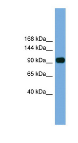 PARP8 Antibody - PARP8 antibody Western blot of Mouse Kidney lysate. This image was taken for the unconjugated form of this product. Other forms have not been tested.