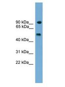 PARP8 Antibody - PARP8 antibody Western Blot of Mouse Thymus.  This image was taken for the unconjugated form of this product. Other forms have not been tested.