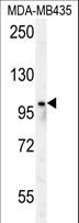 PARP8 Antibody - PARP8 Antibody western blot of MDA-MB435 cell line lysates (35 ug/lane). The PARP8 antibody detected the PARP8 protein (arrow).