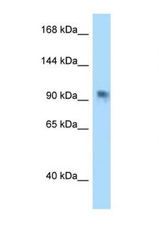PARP8 Antibody - PARP8 antibody Western blot of HeLa Cell lysate. Antibody concentration 1 ug/ml.  This image was taken for the unconjugated form of this product. Other forms have not been tested.