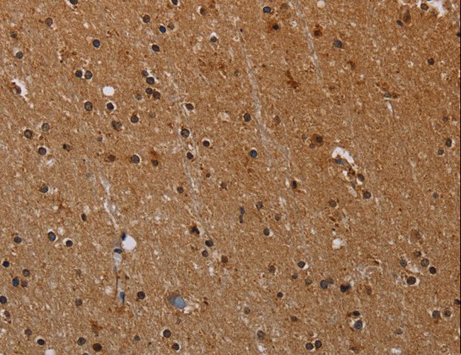 PARP8 Antibody - Immunohistochemistry of paraffin-embedded Human brain using PARP8 Polyclonal Antibody at dilution of 1:40.