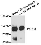 PARP8 Antibody - Western blot analysis of extracts of various cell lines, using PARP8 antibody at 1:3000 dilution. The secondary antibody used was an HRP Goat Anti-Rabbit IgG (H+L) at 1:10000 dilution. Lysates were loaded 25ug per lane and 3% nonfat dry milk in TBST was used for blocking. An ECL Kit was used for detection and the exposure time was 90s.