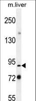 PARP9 Antibody - Parp9 Antibody western blot of mouse liver tissue lysates (35 ug/lane). The Parp9 antibody detected the Parp9 protein (arrow).