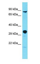 PARPBP / C12orf48 Antibody - PARPBP / C12orf48 antibody Western Blot of Fetal Heart. Antibody dilution: 1 ug/ml.  This image was taken for the unconjugated form of this product. Other forms have not been tested.