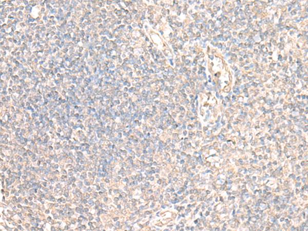 PARS2 Antibody - Immunohistochemistry of paraffin-embedded Human tonsil tissue  using PARS2 Polyclonal Antibody at dilution of 1:30(×200)