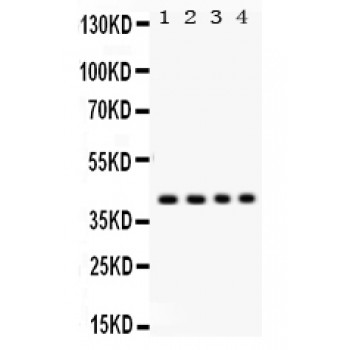PARVA Antibody - Parvin alpha antibody Western blot. All lanes: Anti Parvin alpha at 0.5 ug/ml. Lane 1: Rat Liver Tissue Lysate at 50 ug. Lane 2: HELA Whole Cell Lysate at 40 ug. Lane 3: SW620 Whole Cell Lysate at 40 ug. Lane 4: HEPA Whole Cell Lysate at 40 ug. Predicted band size: 42 kD. Observed band size: 42 kD.