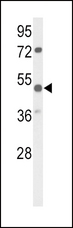 PARVA Antibody - Western blot of PARVA Antibody in mouse bladder tissue lysates (35 ug/lane). PARVA (arrow) was detected using the purified antibody.