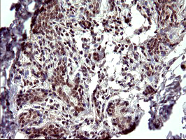 PARVA Antibody - IHC of paraffin-embedded Human breast tissue using anti-PARVA mouse monoclonal antibody. (Heat-induced epitope retrieval by 10mM citric buffer, pH6.0, 120°C for 3min).