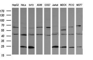 PARVA Antibody - Western blot of extracts (35 ug) from 9 different cell lines by using anti-PARVA monoclonal antibody (HepG2: human; HeLa: human; SVT2: mouse; A549: human; COS7: monkey; Jurkat: human; MDCK: canine; PC12: rat; MCF7: human).
