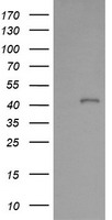 PARVA Antibody - HEK293T cells were transfected with the pCMV6-ENTRY control (Left lane) or pCMV6-ENTRY PARVA (Right lane) cDNA for 48 hrs and lysed. Equivalent amounts of cell lysates (5 ug per lane) were separated by SDS-PAGE and immunoblotted with anti-PARVA.