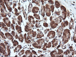PARVA Antibody - IHC of paraffin-embedded Human pancreas tissue using anti-PARVA mouse monoclonal antibody.