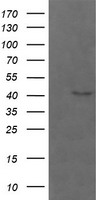 PARVA Antibody - HEK293T cells were transfected with the pCMV6-ENTRY control (Left lane) or pCMV6-ENTRY PARVA (Right lane) cDNA for 48 hrs and lysed. Equivalent amounts of cell lysates (5 ug per lane) were separated by SDS-PAGE and immunoblotted with anti-PARVA.