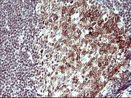 PARVA Antibody - IHC of paraffin-embedded Human lymph node tissue using anti-PARVA mouse monoclonal antibody. (Heat-induced epitope retrieval by 10mM citric buffer, pH6.0, 120°C for 3min).